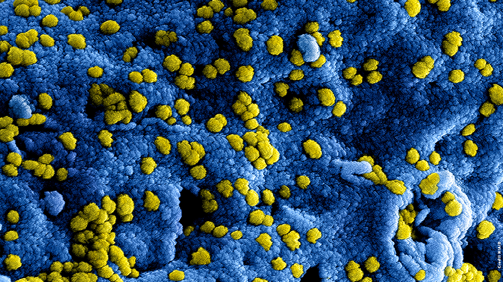 MERS coronavirus
