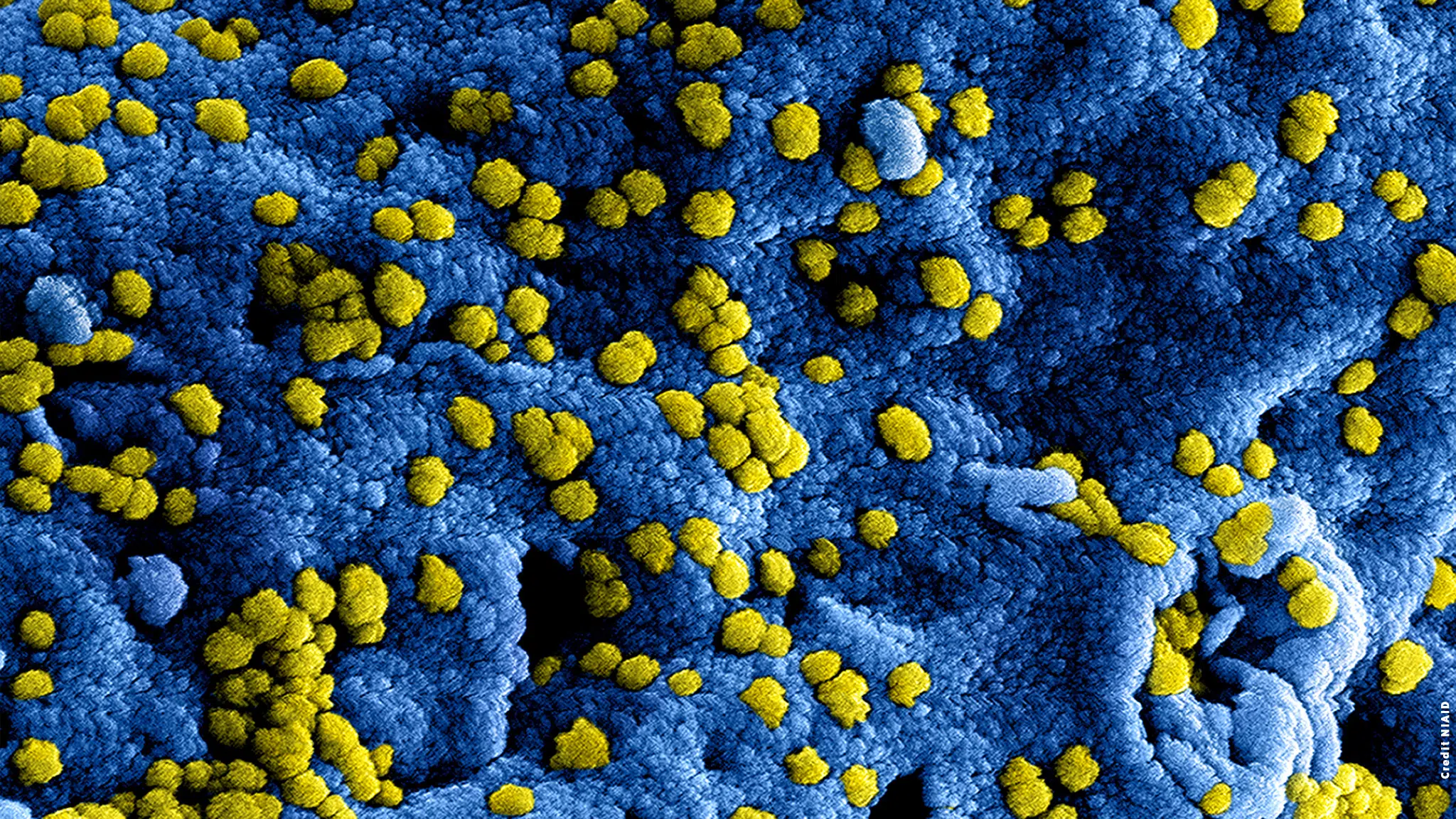 MERS coronavirus